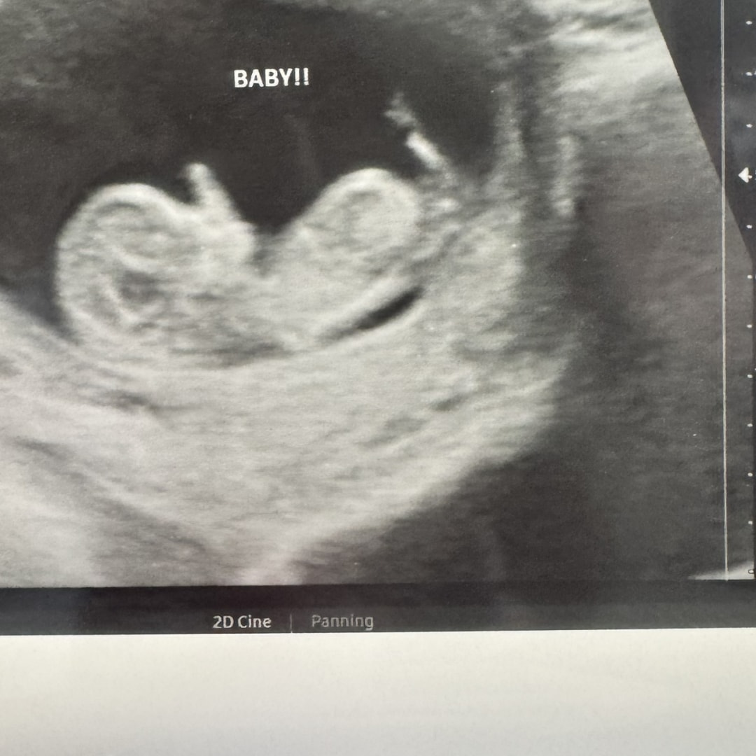 Photo shared by Hailey for their Babylist baby registry.