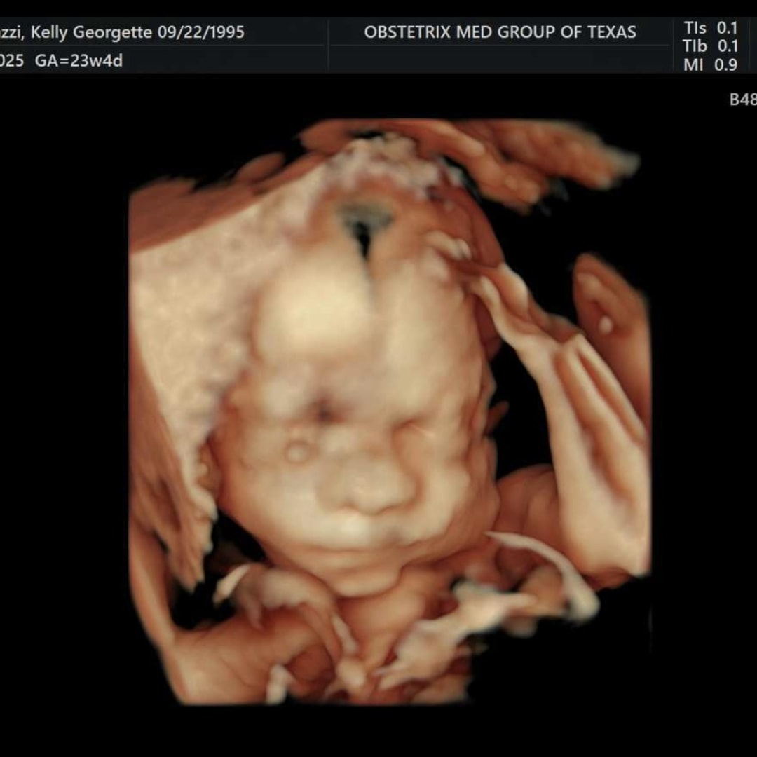 Photo shared by Kelly for their Babylist baby registry.