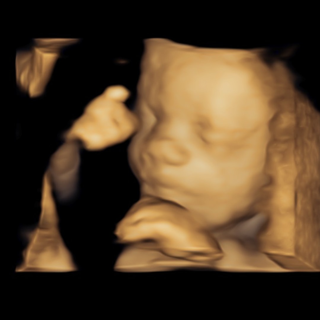 Photo shared by Melinda for their Babylist baby registry.