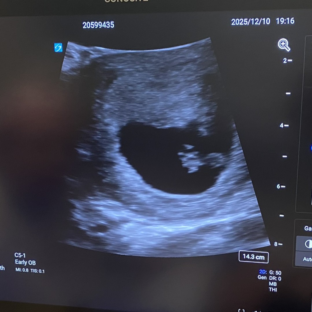 Photo shared by Angel for their Babylist baby registry.