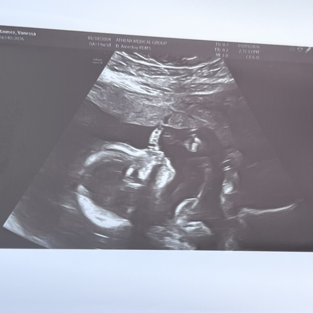 Photo shared by Vanessa for their Babylist baby registry.