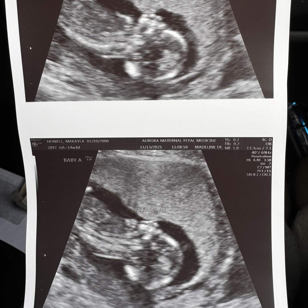 Photo shared by Makayla for their Babylist baby registry.