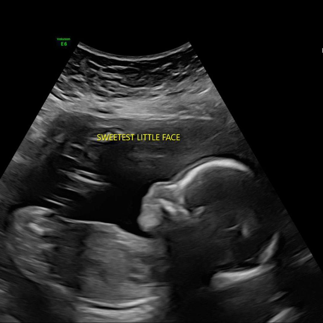 Photo shared by Hope for their Babylist baby registry.