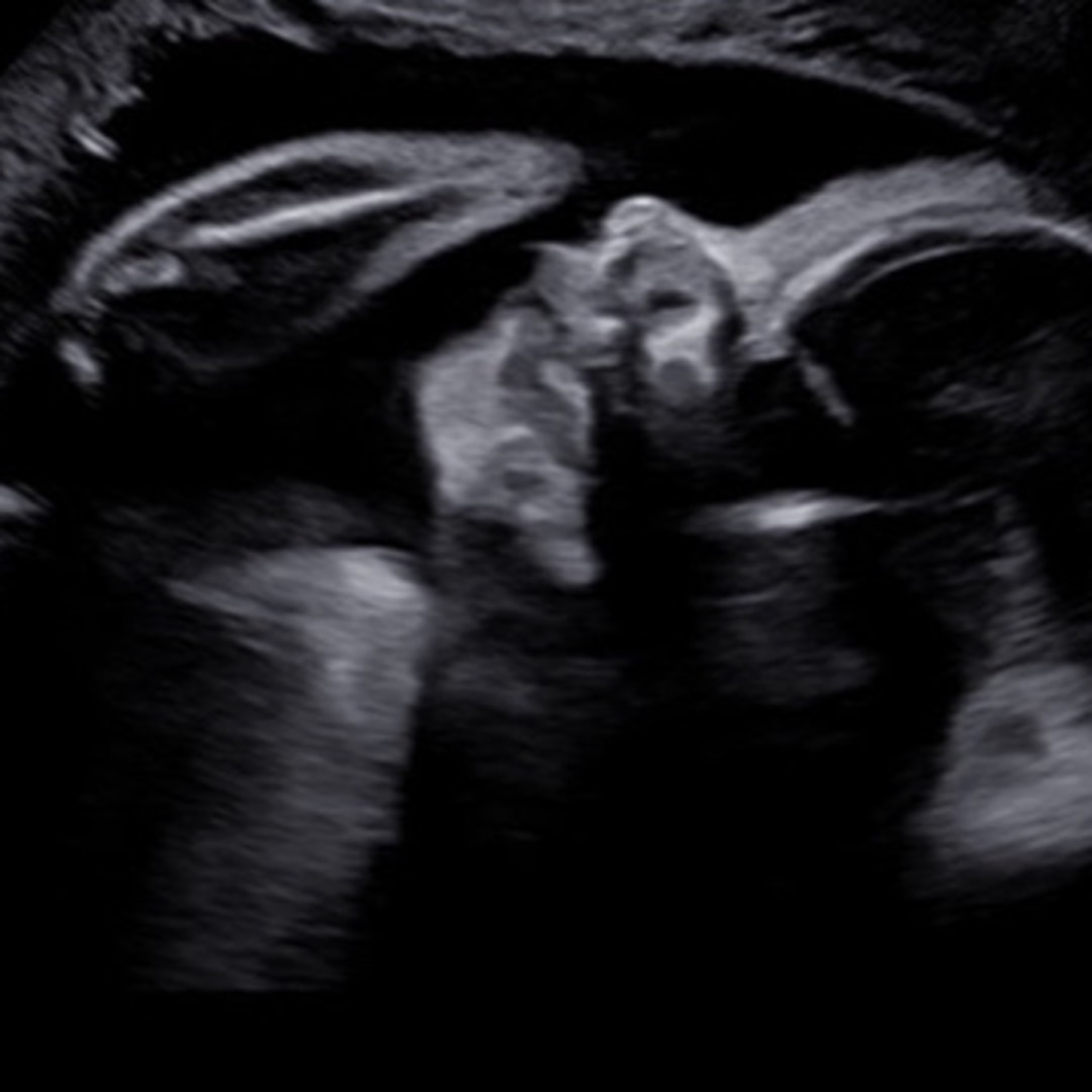 Photo shared by Emily for their Babylist baby registry.