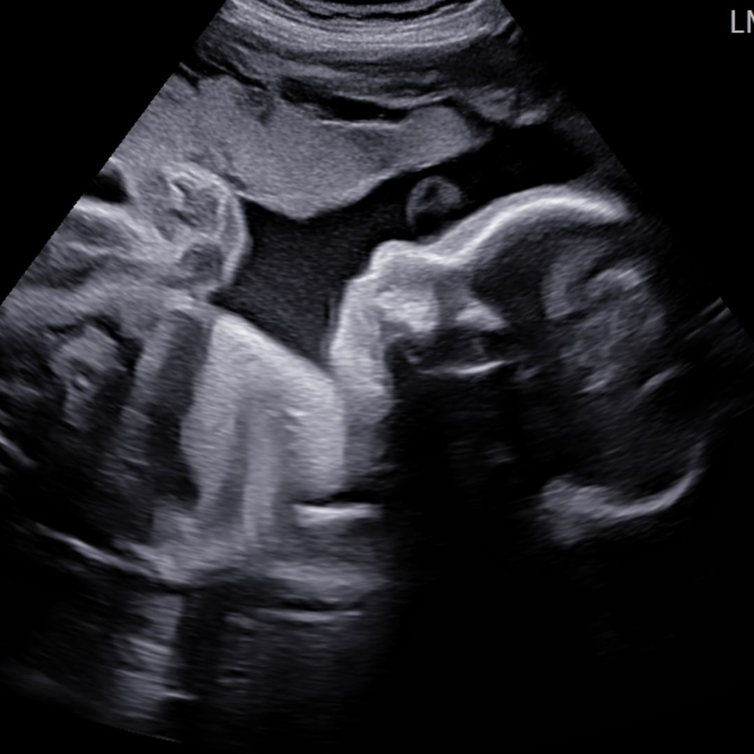 Photo shared by Sara for their Babylist baby registry.