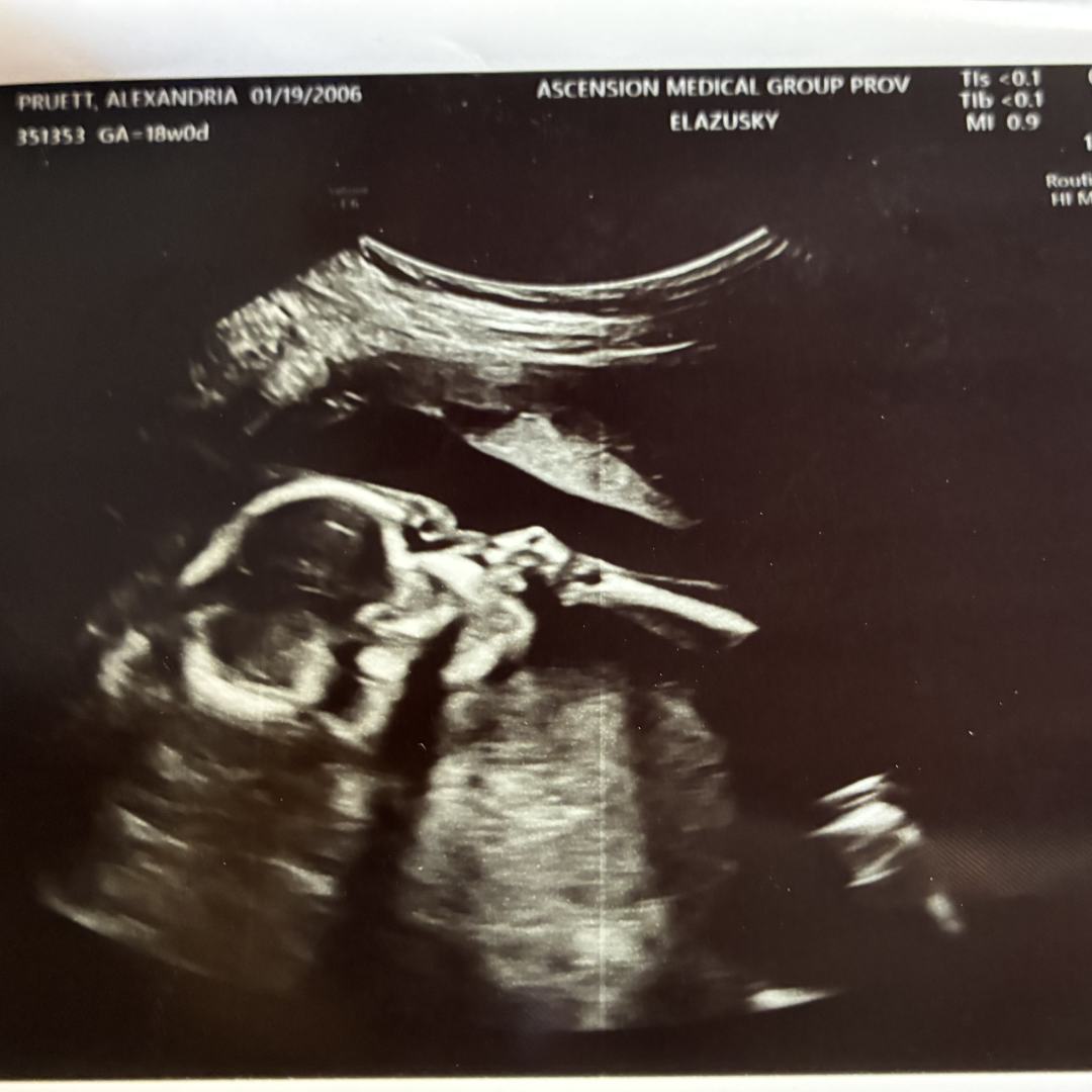 Photo shared by Alley for their Babylist baby registry.
