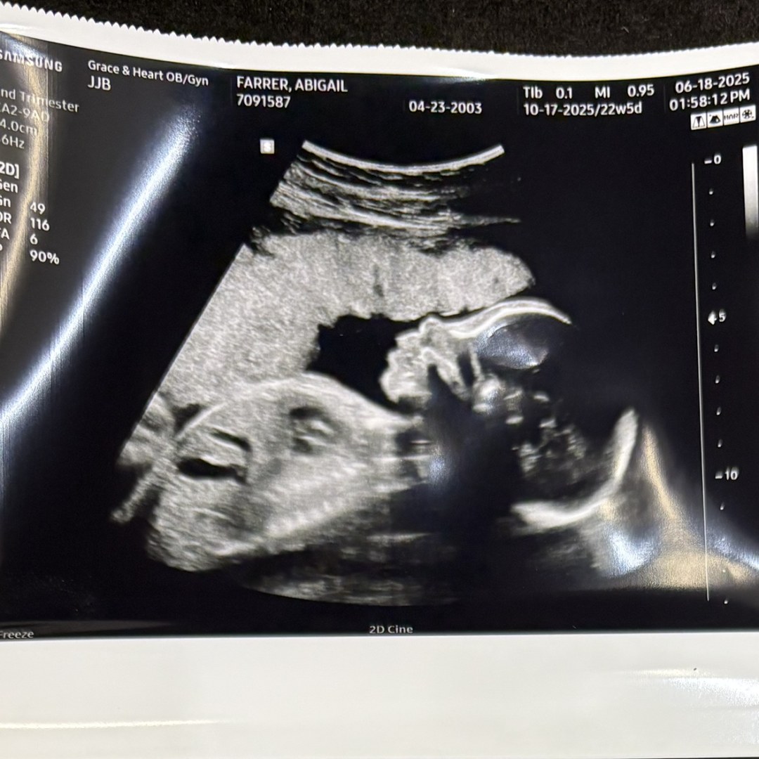 Photo shared by Abigail for their Babylist baby registry.
