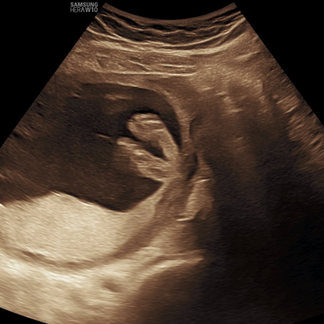 Photo shared by Delaney for their Babylist baby registry.