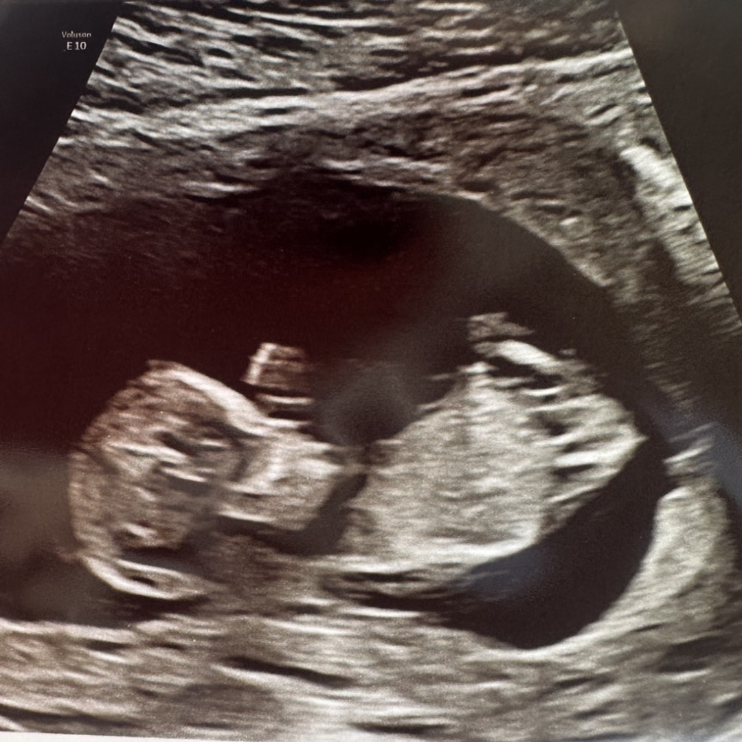 Photo shared by Sydney for their Babylist baby registry.