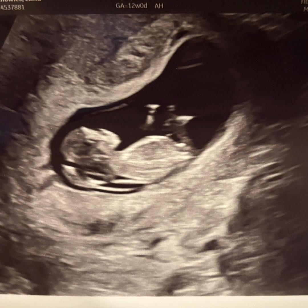 Photo shared by Lania for their Babylist baby registry.