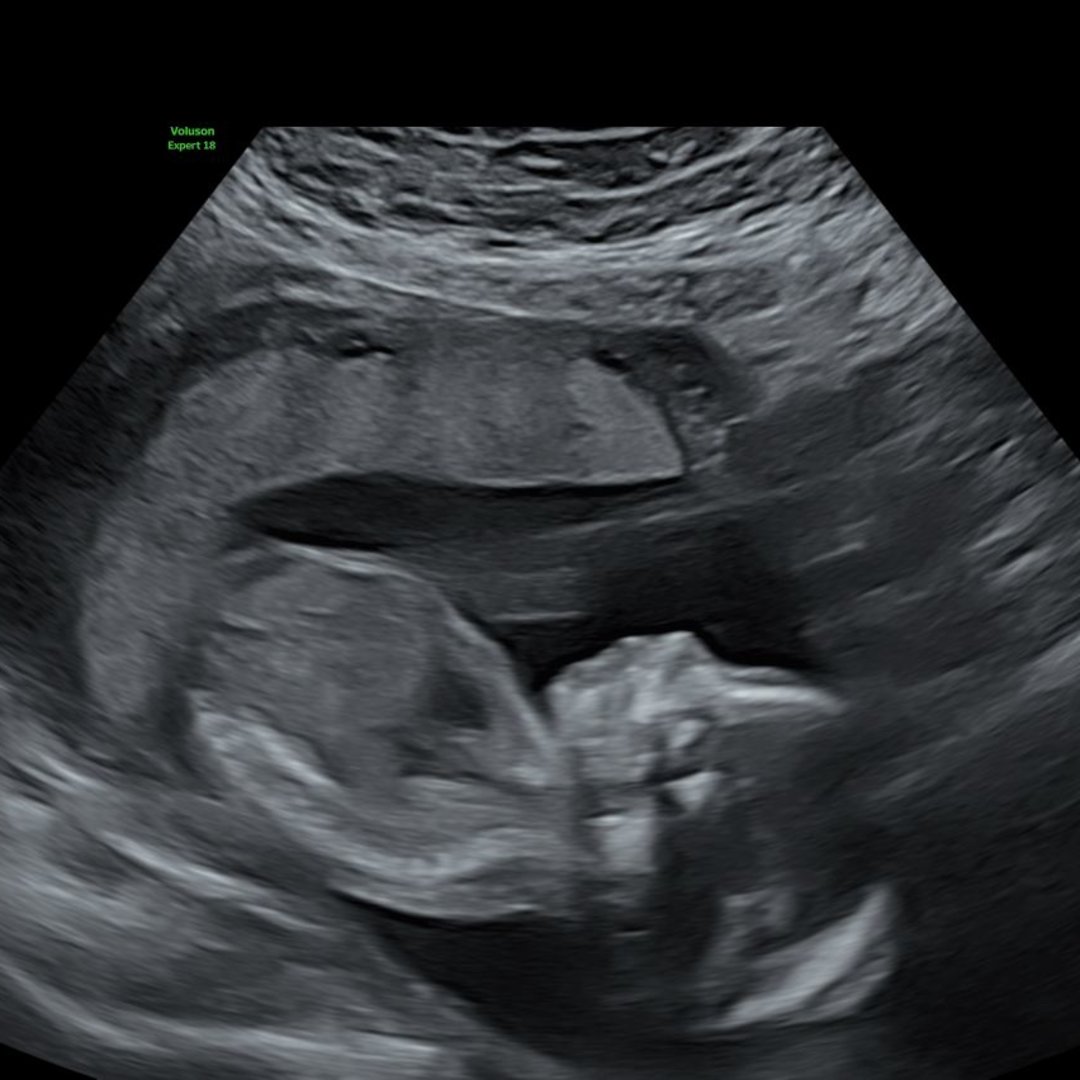 Photo shared by Damyan for their Babylist baby registry.