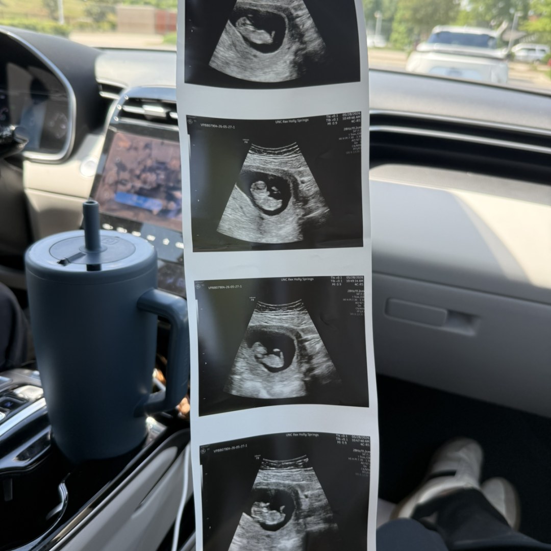 Photo shared by Madison for their Babylist baby registry.