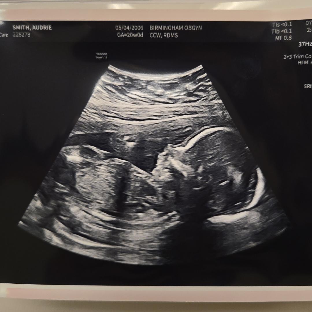 Photo shared by Audrie for their Babylist baby registry.