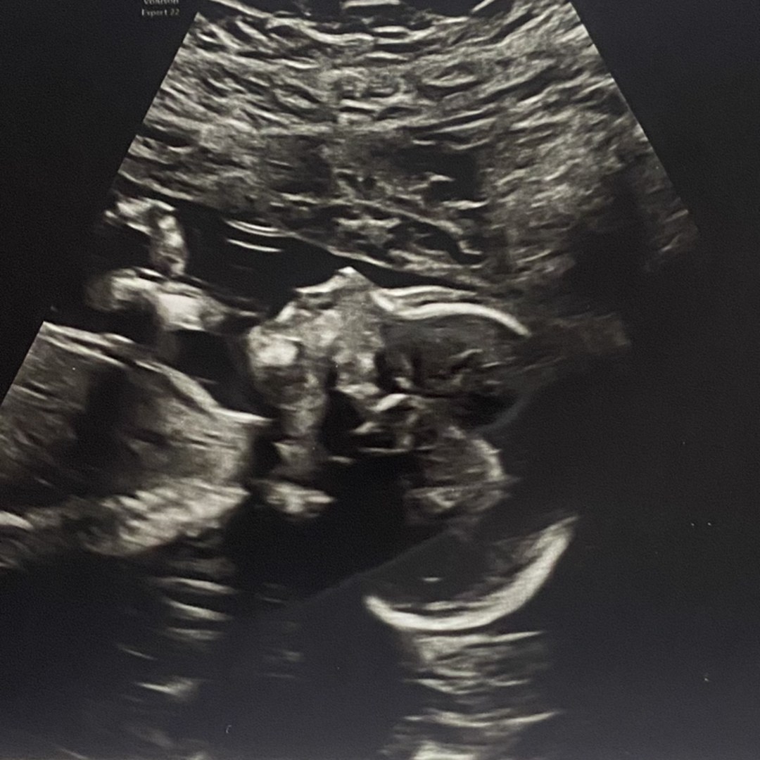 Photo shared by Kathryn for their Babylist baby registry.