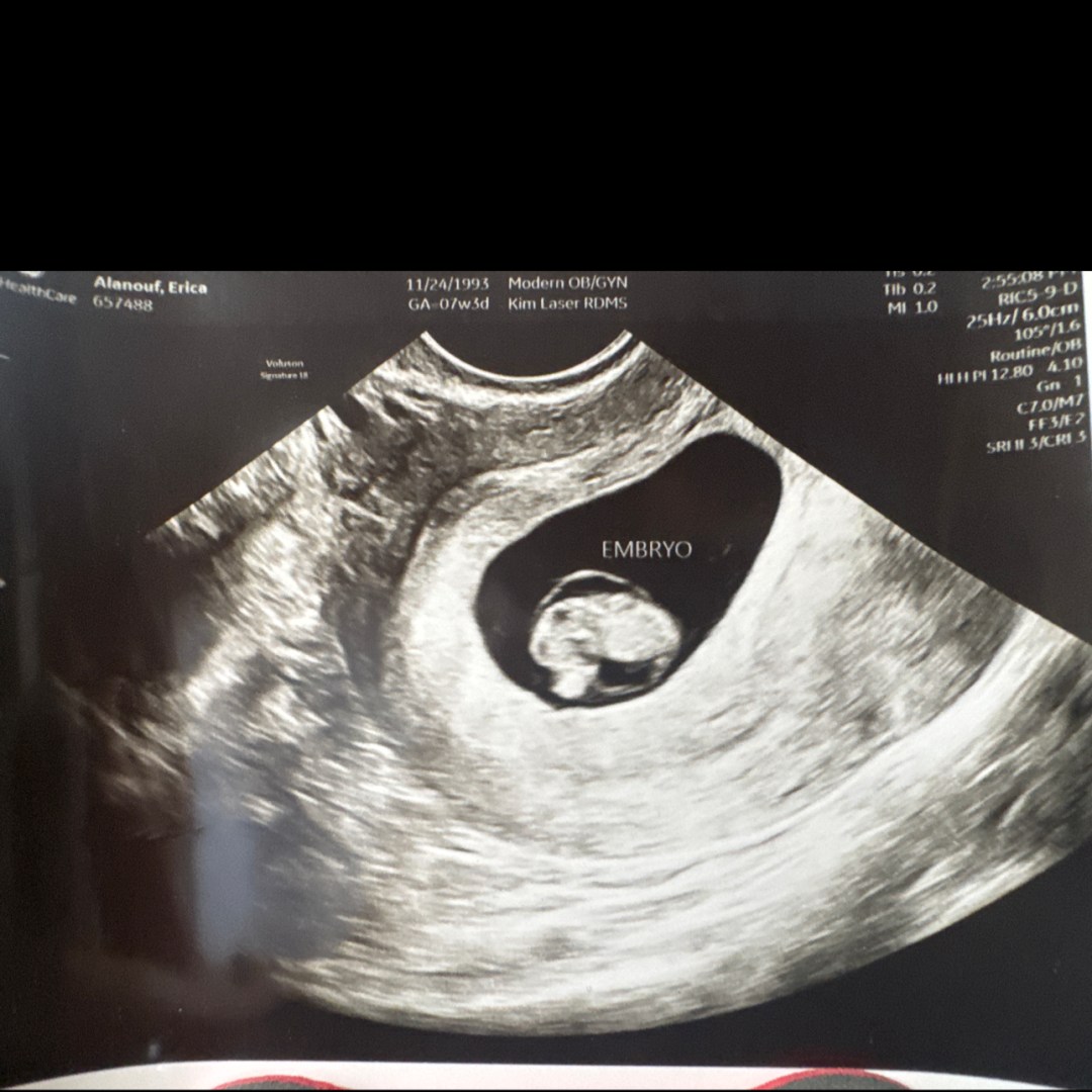 Photo shared by Erica for their Babylist baby registry.