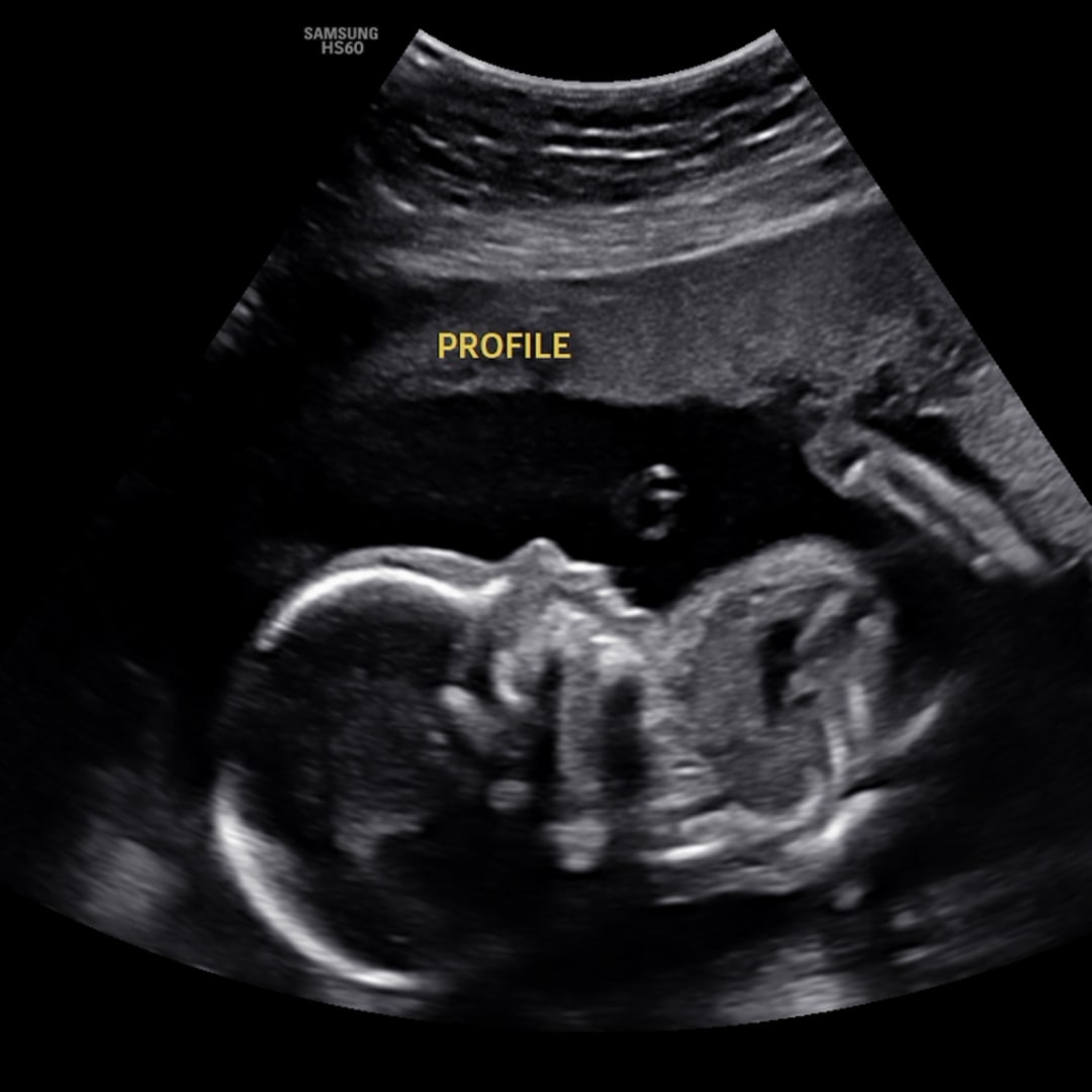 Photo shared by Abigail for their Babylist baby registry.