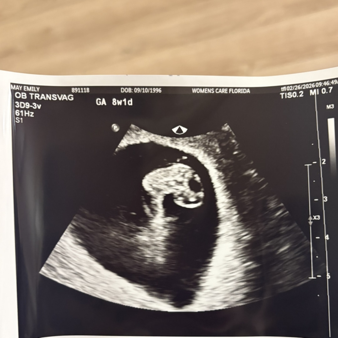 Photo shared by Emily for their Babylist baby registry.