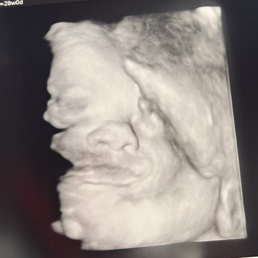 Photo shared by Anna for their Babylist baby registry.