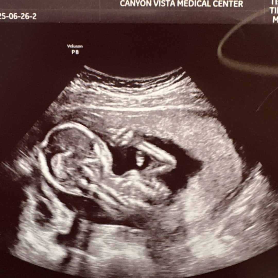 Photo shared by Erin for their Babylist baby registry.