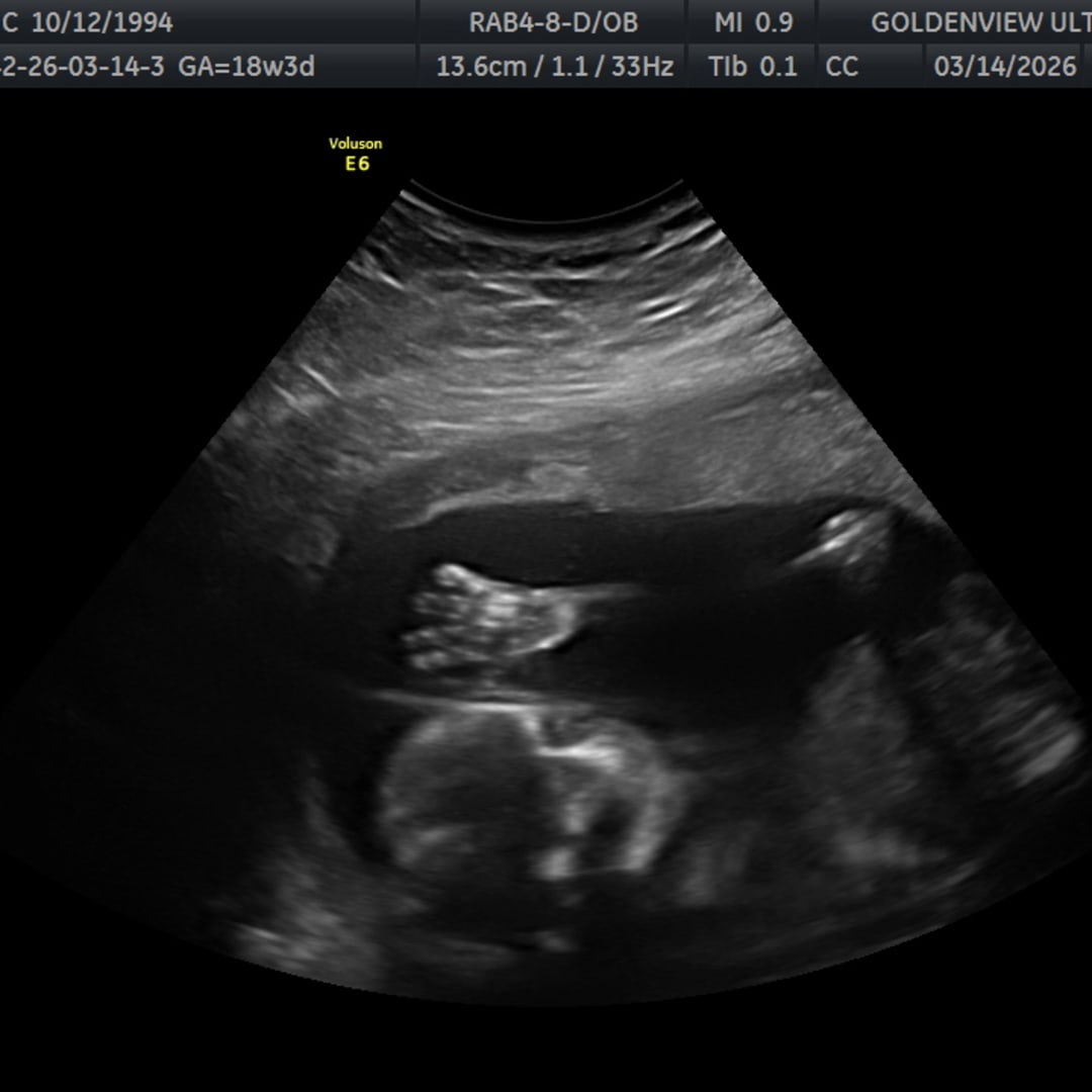 Photo shared by Carli for their Babylist baby registry.