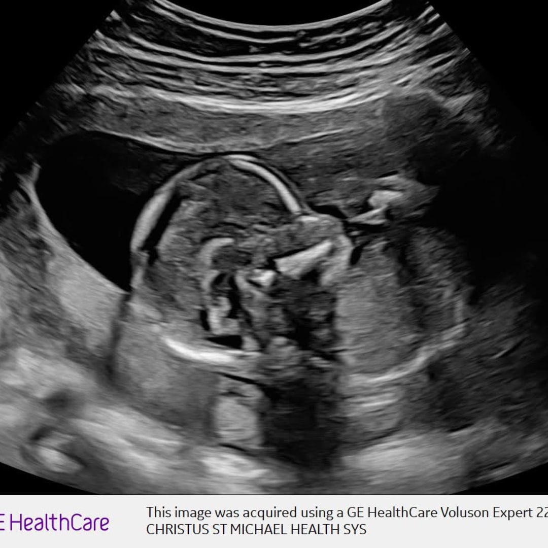 Photo shared by Diana for their Babylist baby registry.