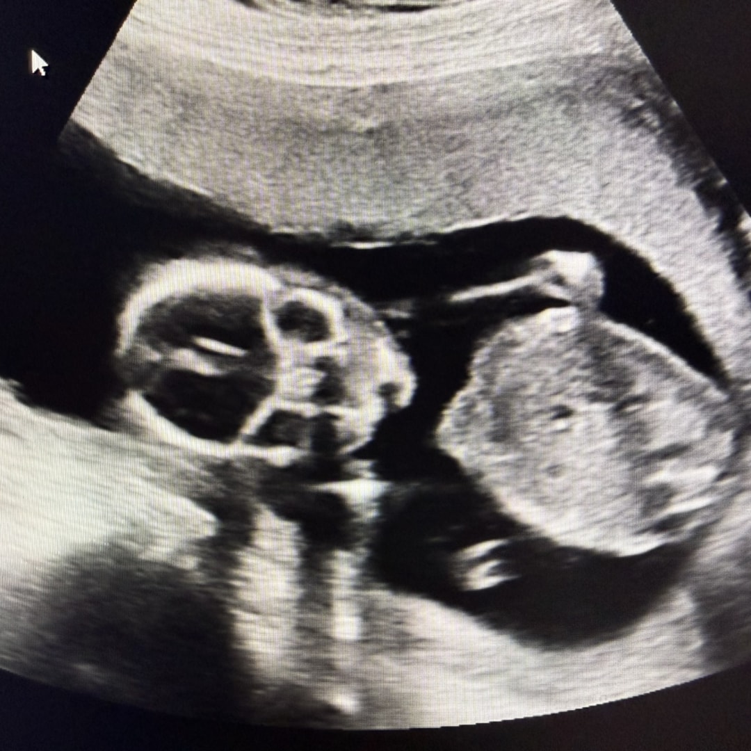 Photo shared by Ashley for their Babylist baby registry.