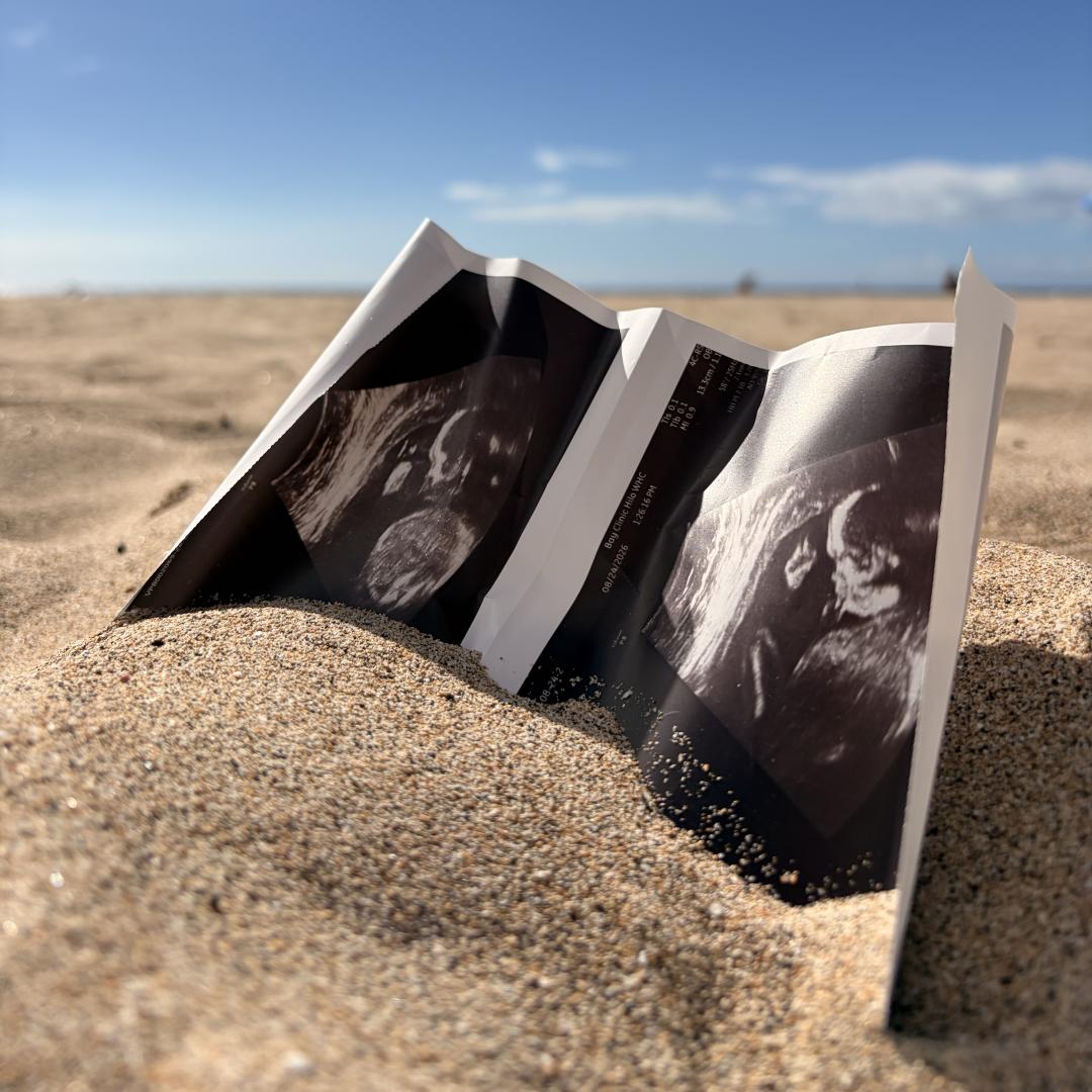 Photo shared by Shylen for their Babylist baby registry.