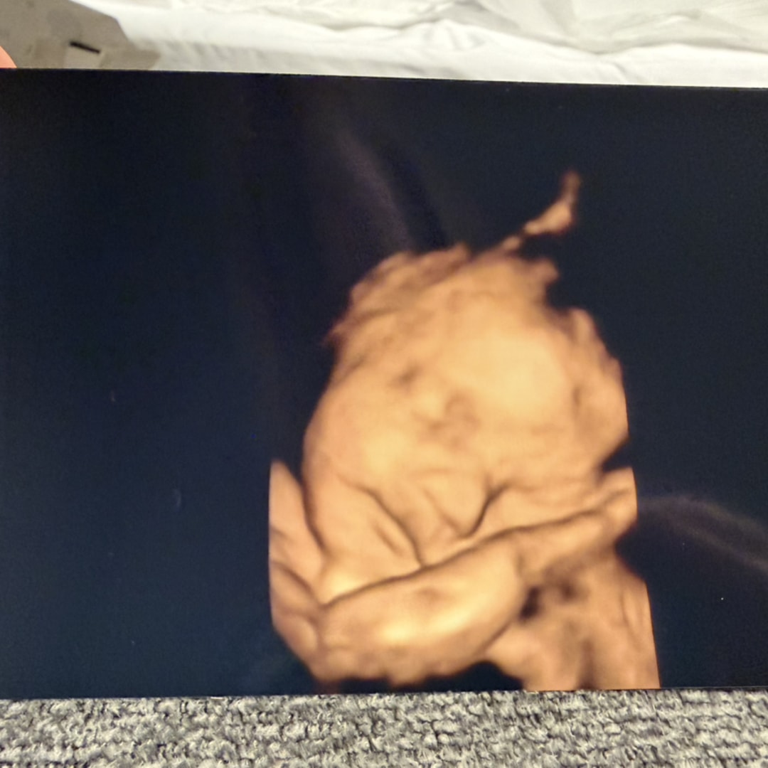 Photo shared by Rachel for their Babylist baby registry.