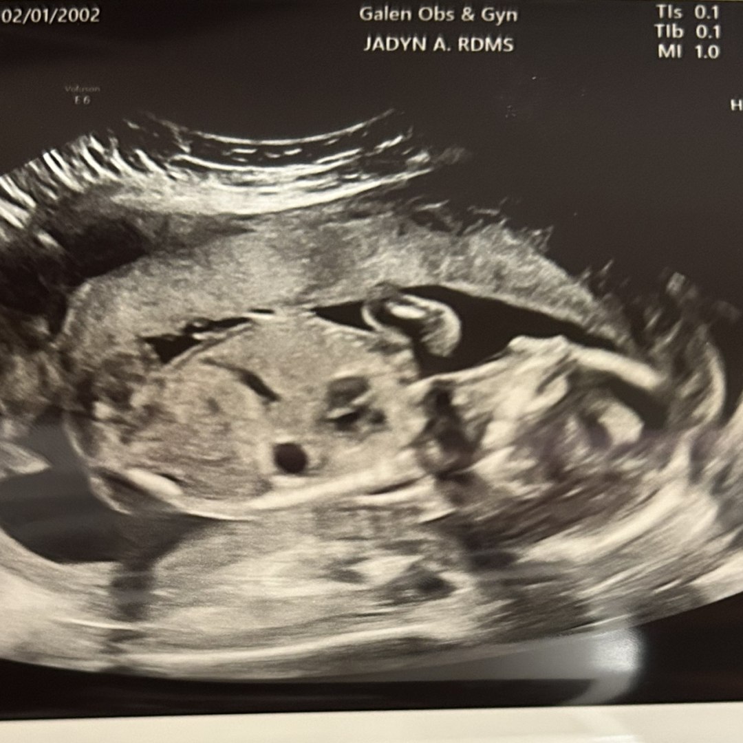 Photo shared by Katelyn for their Babylist baby registry.