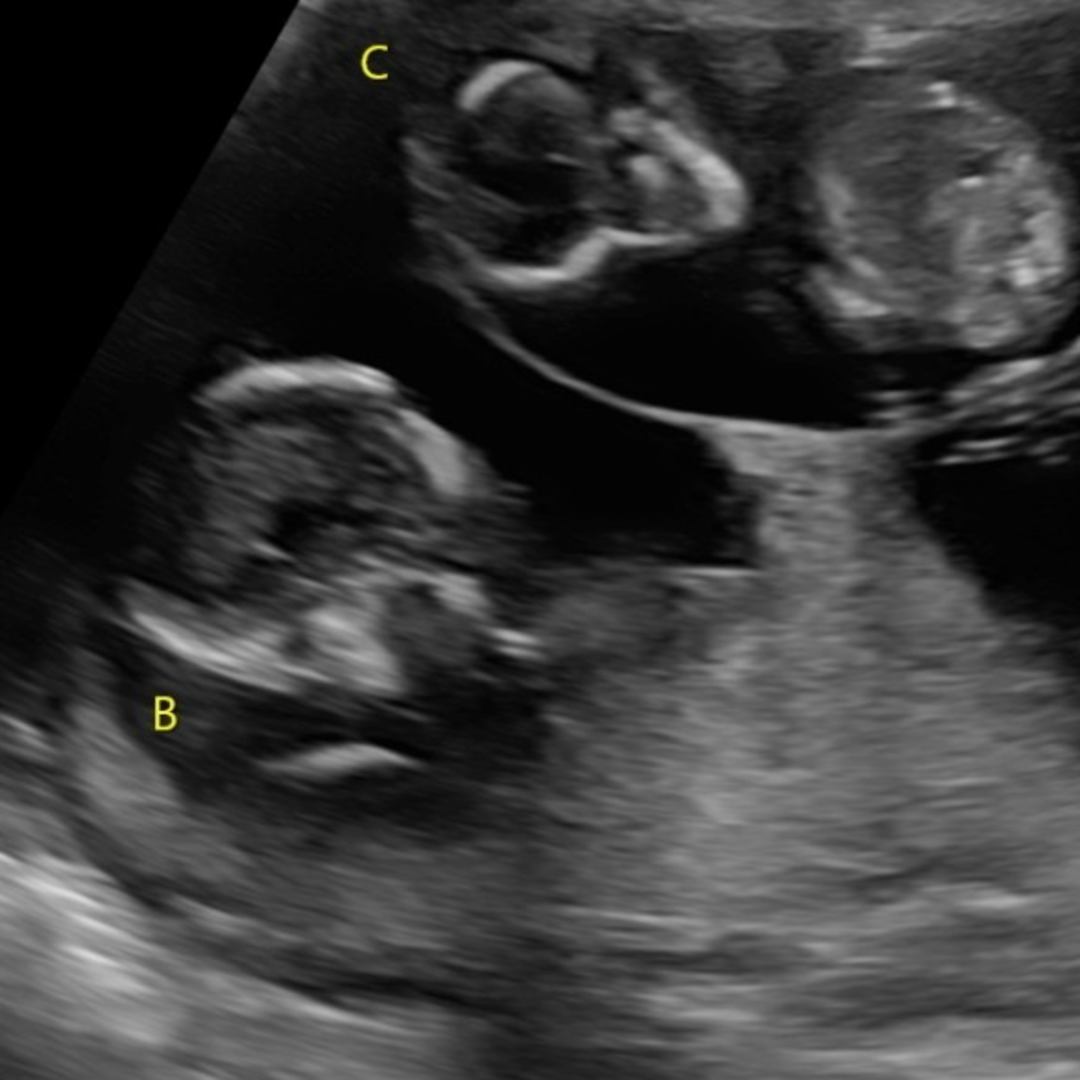 Photo shared by Karalyn for their Babylist baby registry.