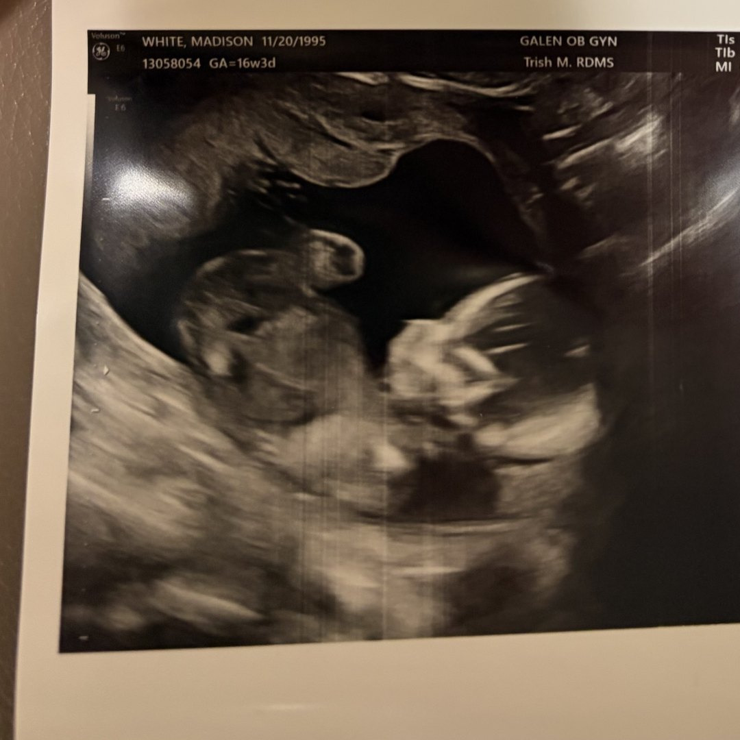Photo shared by Madison for their Babylist baby registry.