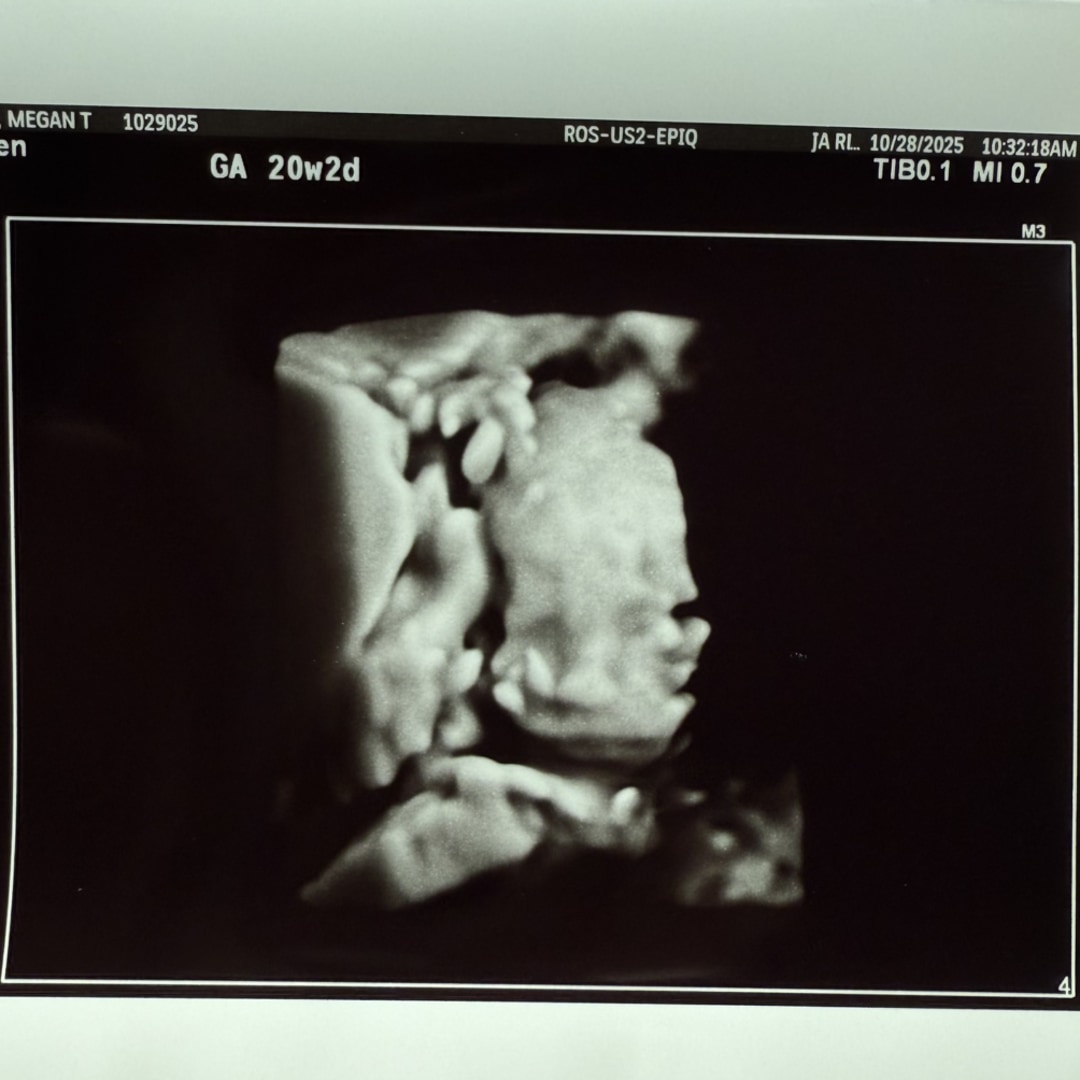 Photo shared by Megan for their Babylist baby registry.