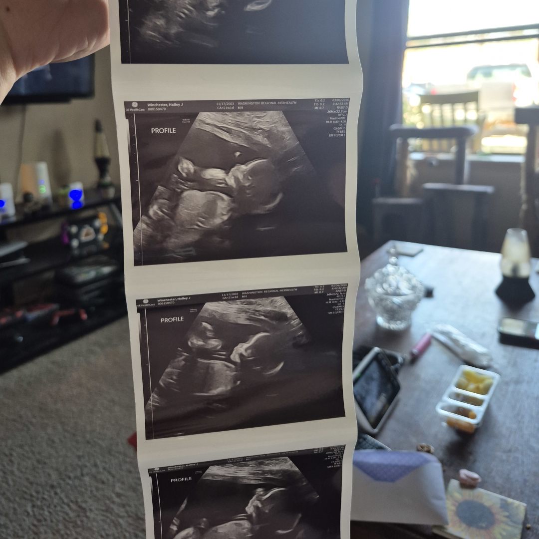 Photo shared by Halley for their Babylist baby registry.