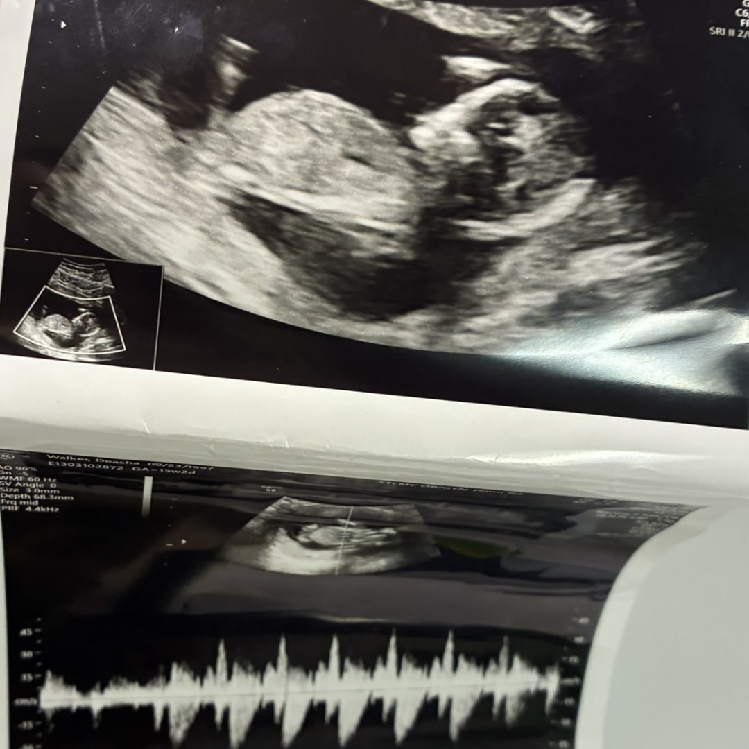 Photo shared by Deasha for their Babylist baby registry.