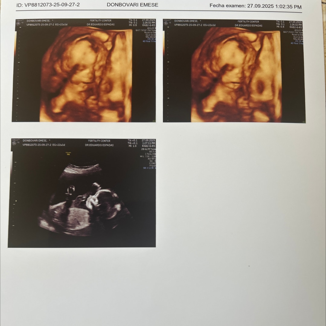 Photo shared by Emese for their Babylist baby registry.