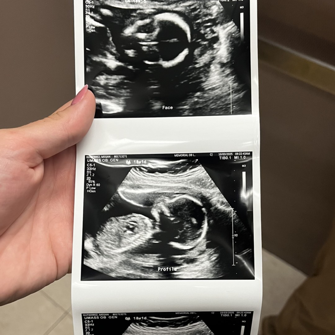 Photo shared by Megan for their Babylist baby registry.