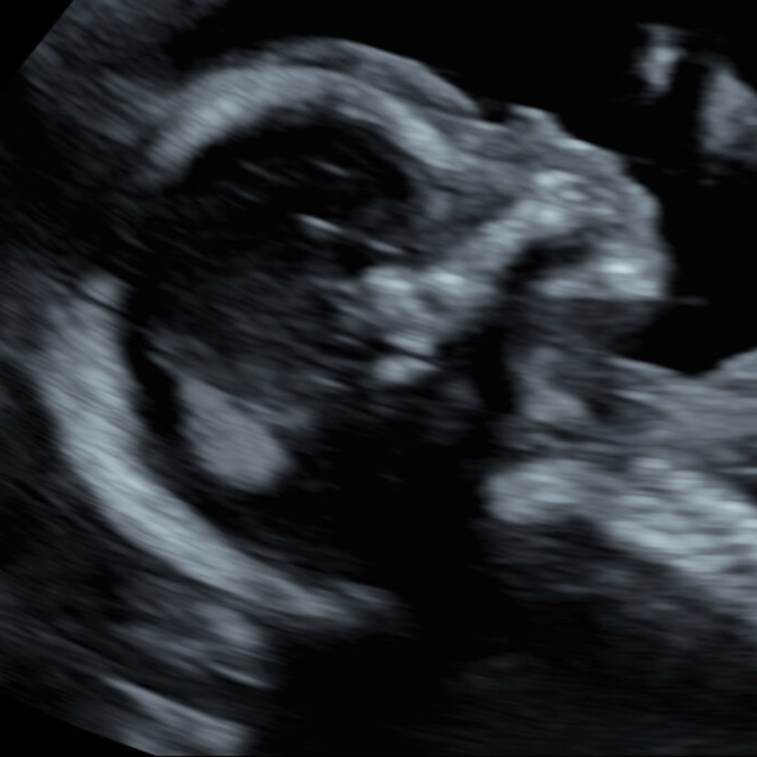 Photo shared by Amber for their Babylist baby registry.
