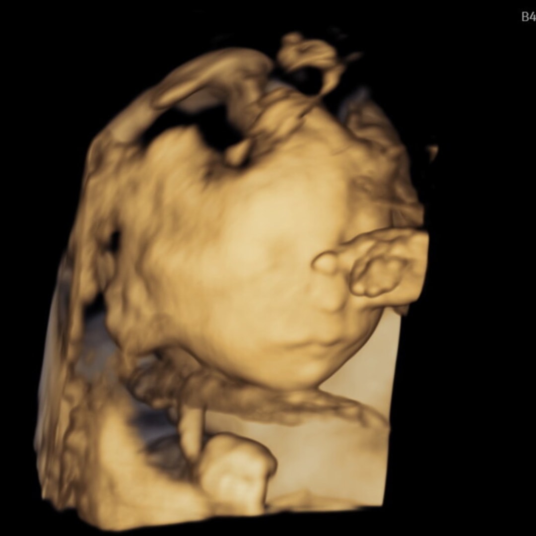 Photo shared by Lauren for their Babylist baby registry.