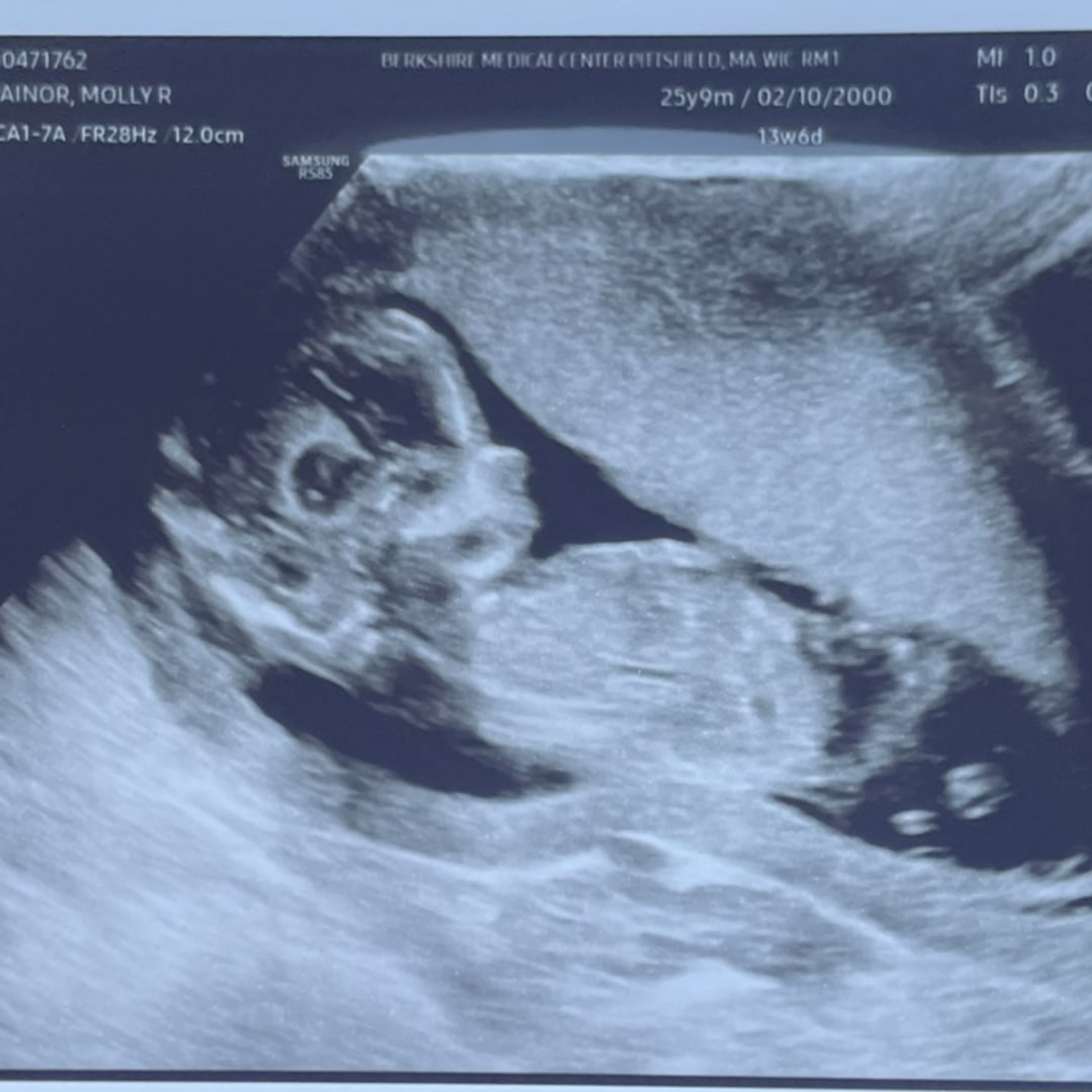 Photo shared by Molly for their Babylist baby registry.