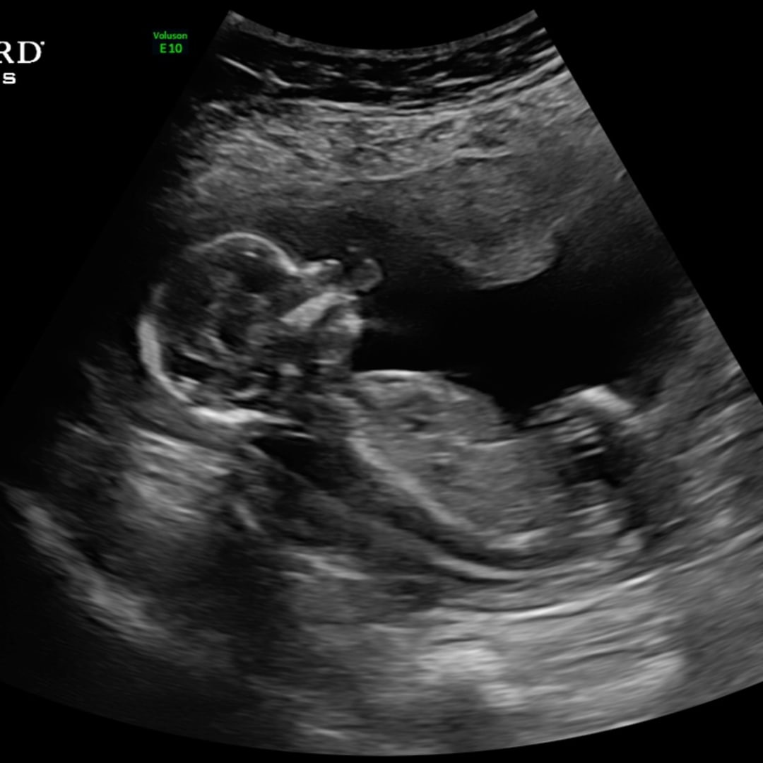 Photo shared by Blakeley for their Babylist baby registry.