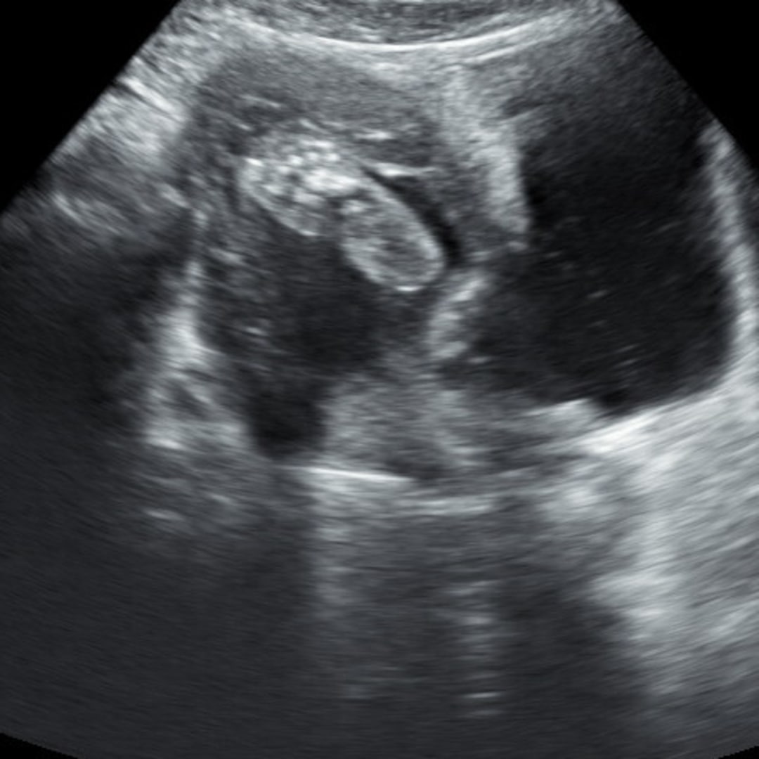 Photo shared by Lily for their Babylist baby registry.