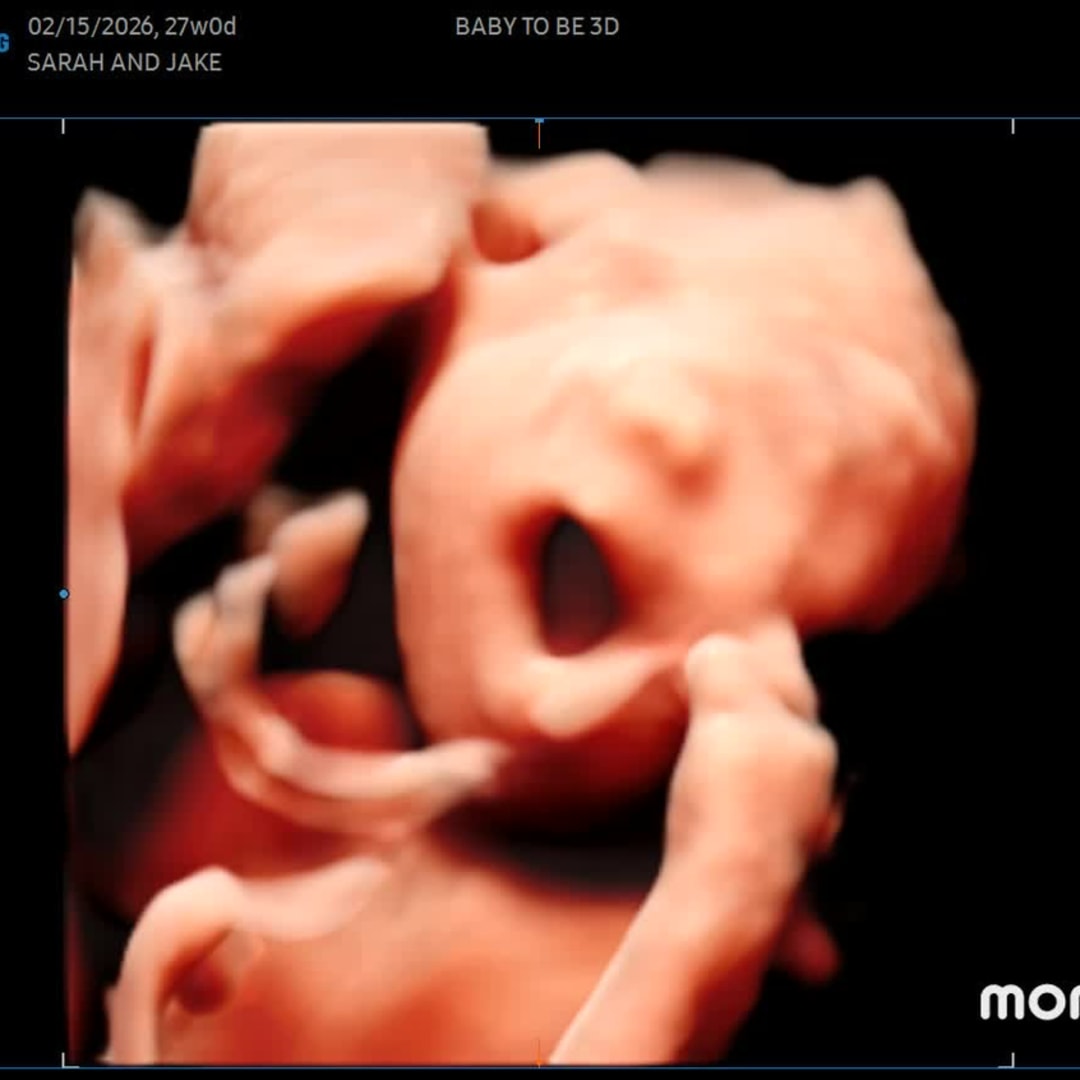 Photo shared by Sara for their Babylist baby registry.