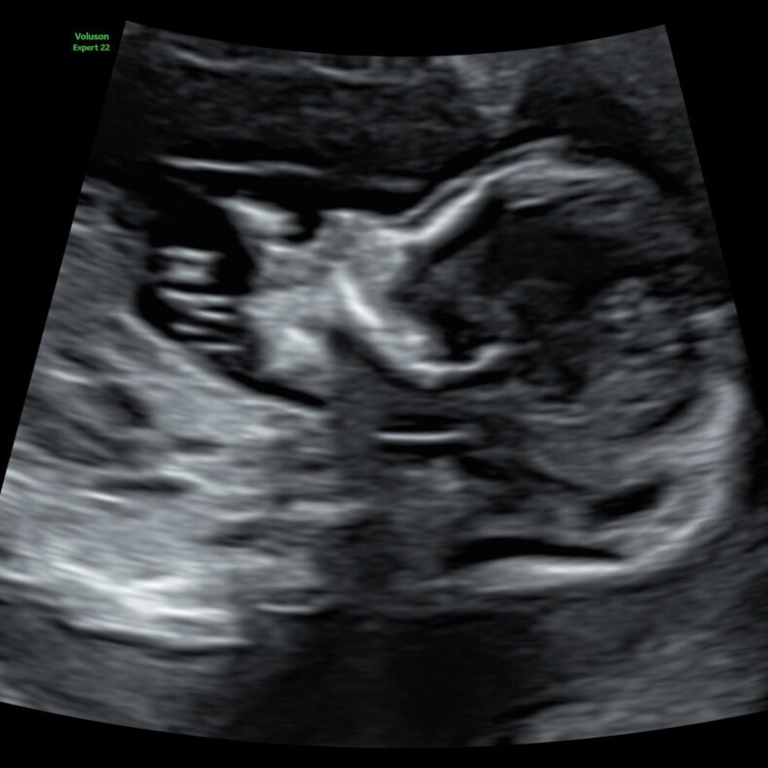 Photo shared by Jackie for their Babylist baby registry.