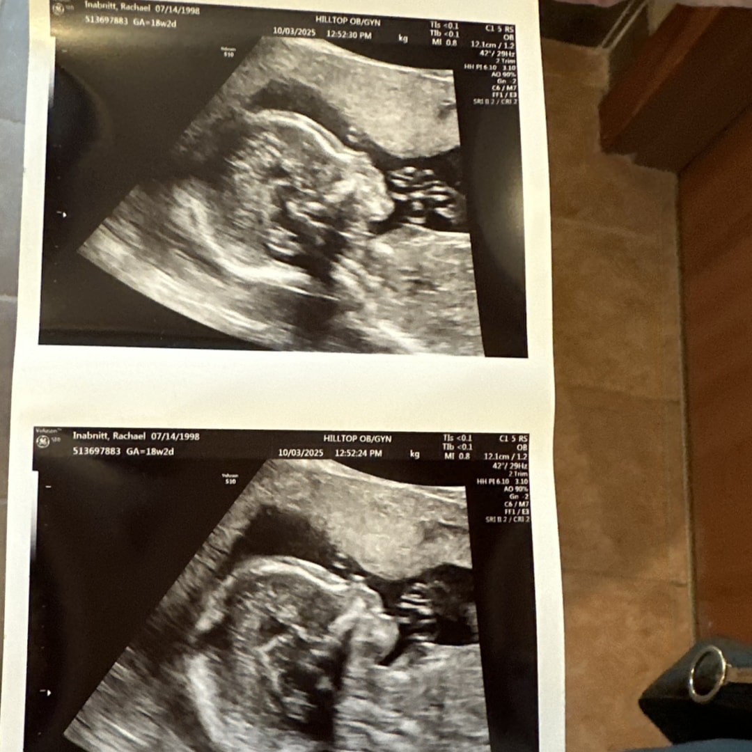 Photo shared by Cristi C/O TRISH Inabnitt for their Babylist baby registry.