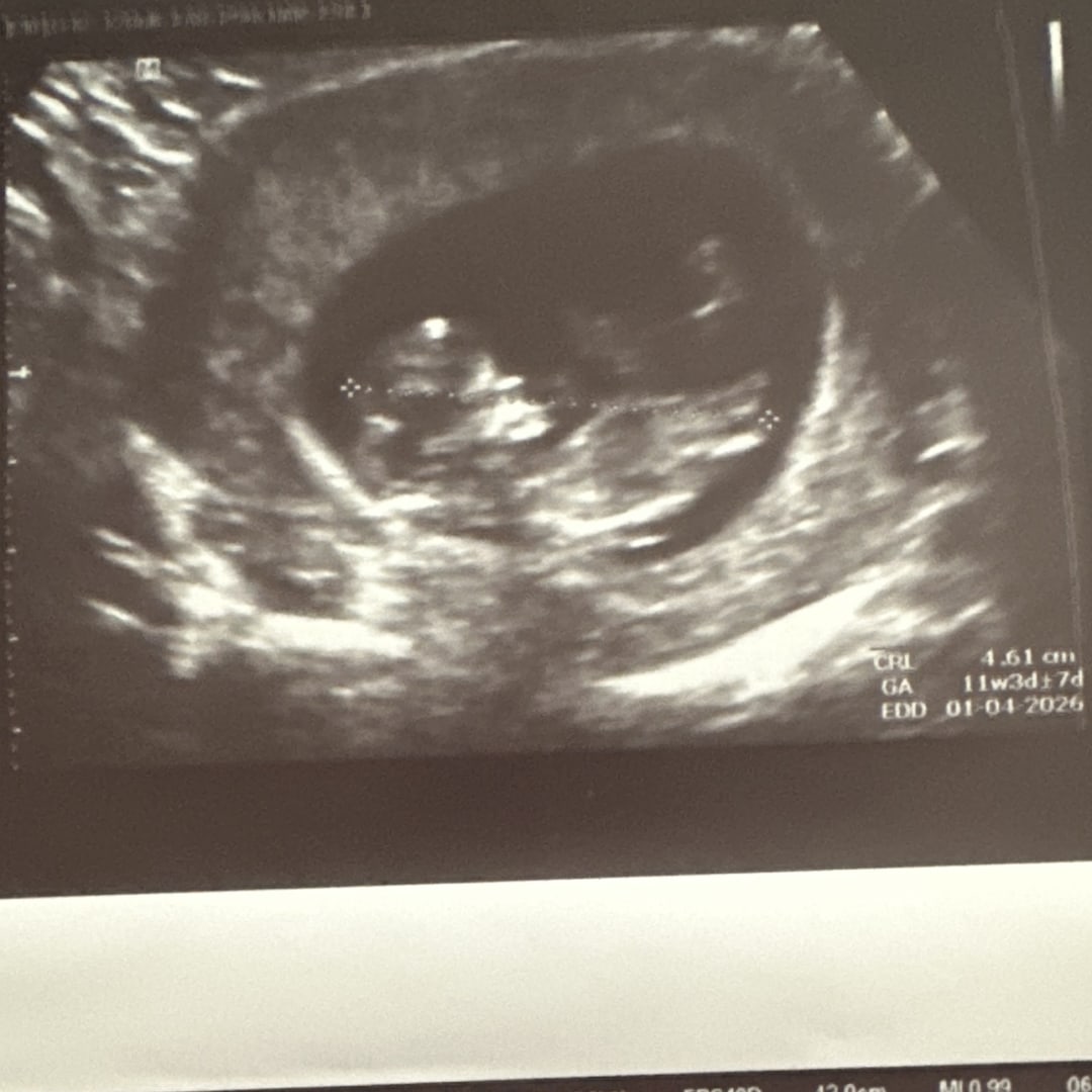 Photo shared by Libby for their Babylist baby registry.