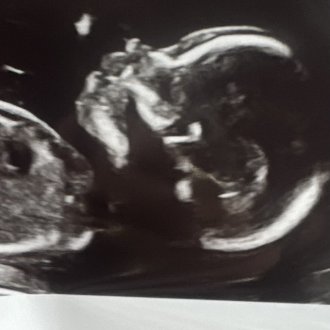 Photo shared by Guadalupe for their Babylist baby registry.