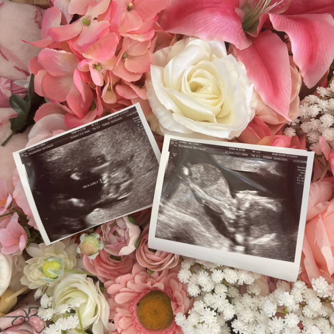 Photo shared by Victoria for their Babylist baby registry.