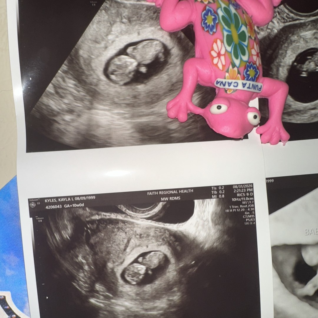 Photo shared by Kayla for their Babylist baby registry.