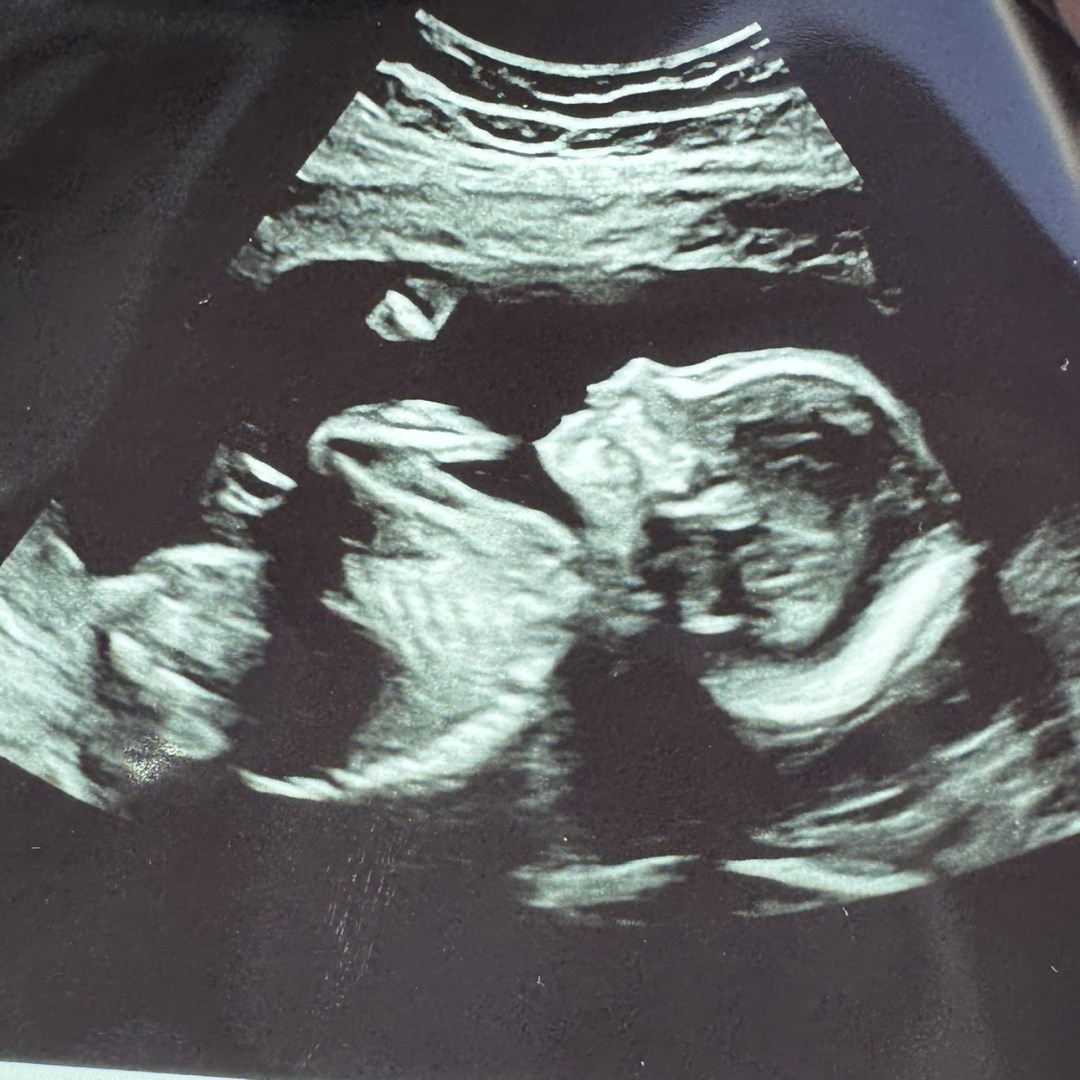 Photo shared by Raychel for their Babylist baby registry.