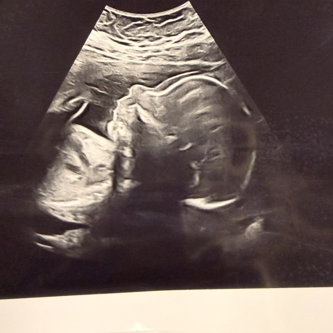Photo shared by Emily for their Babylist baby registry.